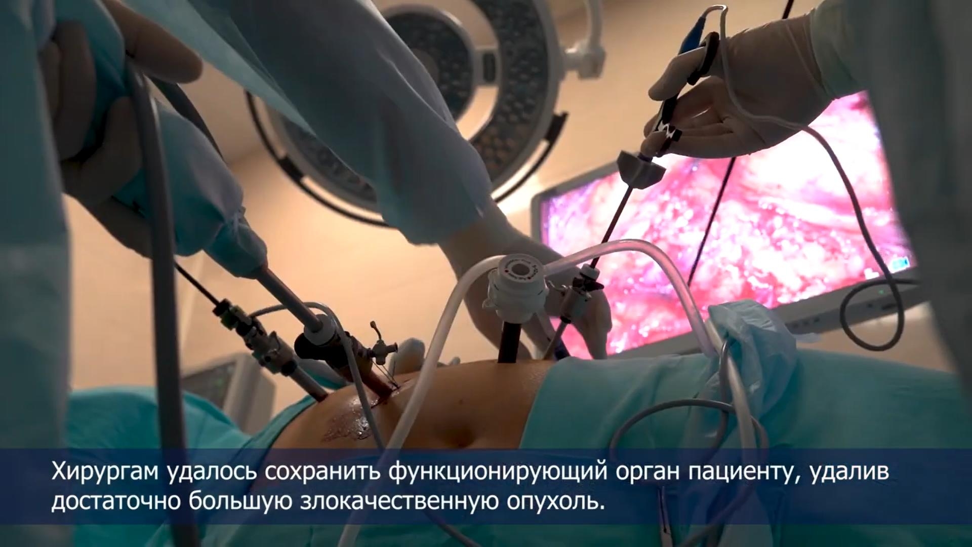 Урологи Сеченовского Университета перед операцией применяют уникальную 3D-программу